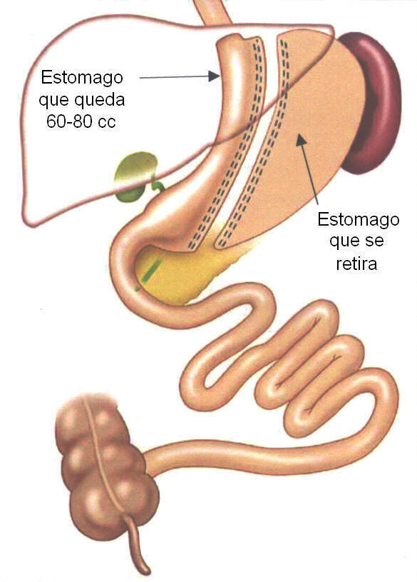 Notícia